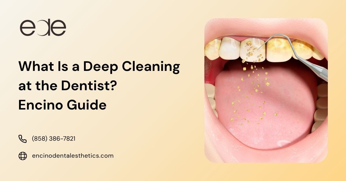 Illustration of plaque and tartar removal during a dental deep cleaning.