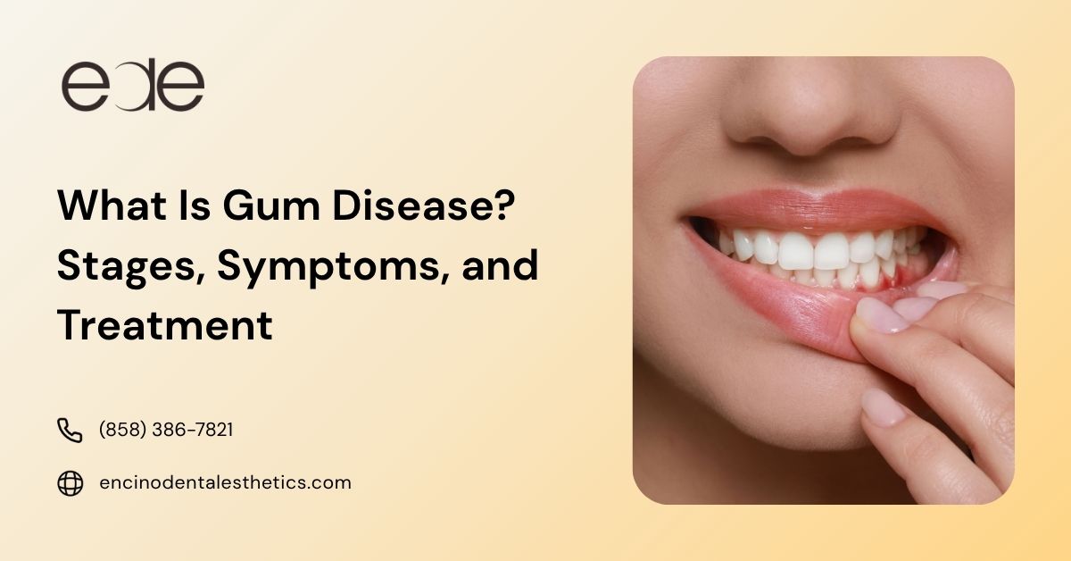 Woman showing red, irritated gums, a common symptom of gum disease.