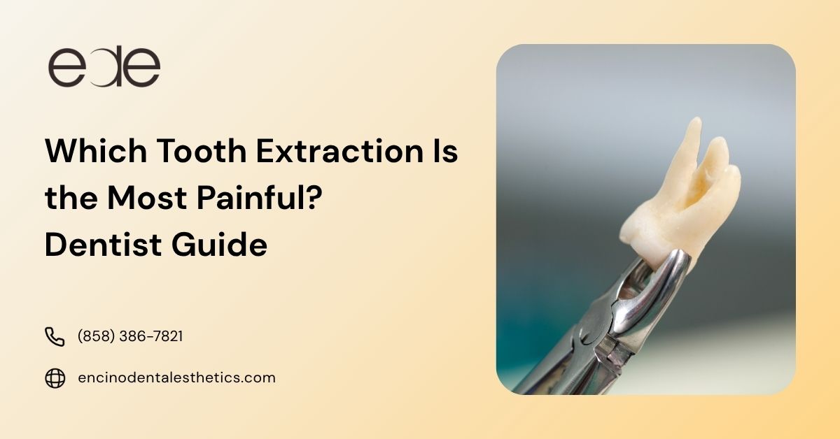 An extracted molar held by dental forceps next to text asking "Which tooth extraction is the most painful?", providing a dentist guide for patient information.