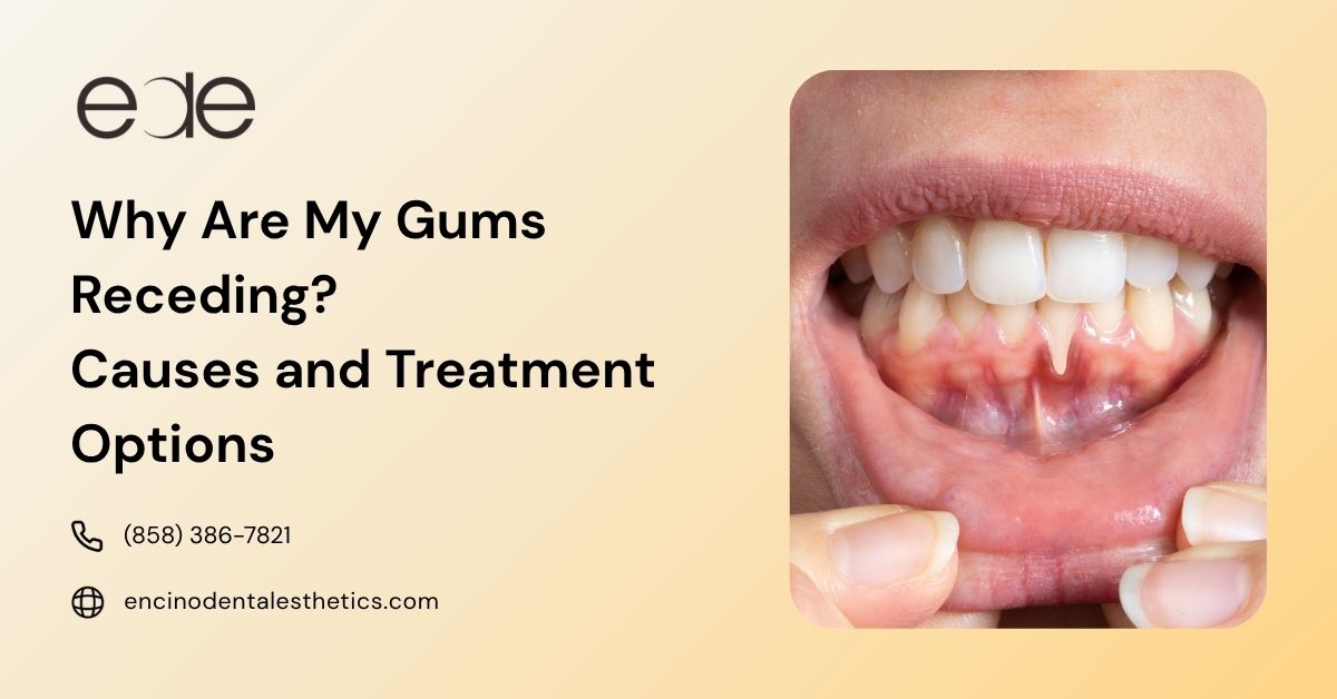 Why Are My Gums Receding and What Can I Do About It?